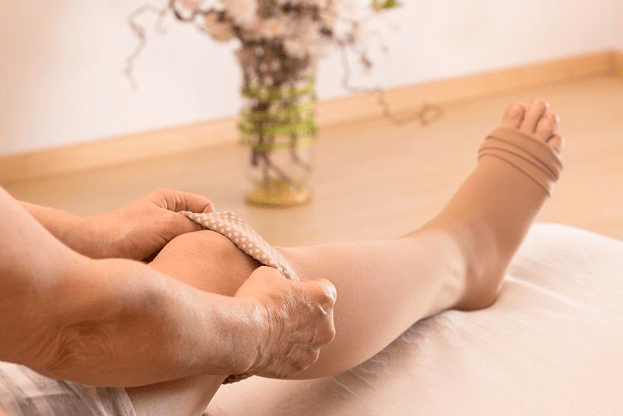 Sclerotherapy