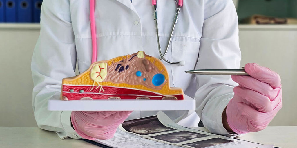 Doctor Explaining Dense Breast Tissue